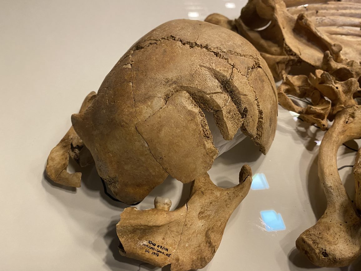 De gehavende schedel van de Viking die is gevonden bij Oxford. © Troels Donnerborg, via Nationalmuseet