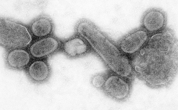Het virus werd gereconstrueerd en ligt nu opgeslagen in bewaakte laboratoria. Hier zien we er een elektronenmicroscopische foto van het griepvirus. Cyntia Goldsmith, Reconstructed Spanish flu virus (2005). Bron: Wikimedia Commons/CDC (PD)